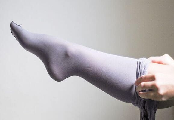 compression tights for varicose veins