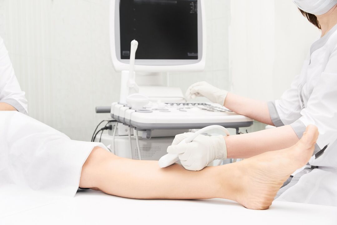 diagnostic ultrasound of varicose veins