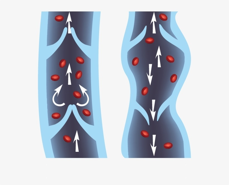 how the venous valve apparatus works